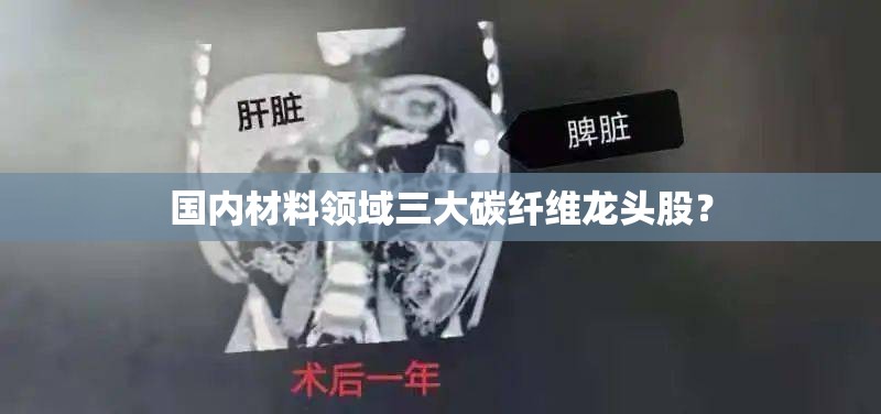 国内材料领域三大碳纤维龙头股? 国内材料领域三大碳纤维龙头股?